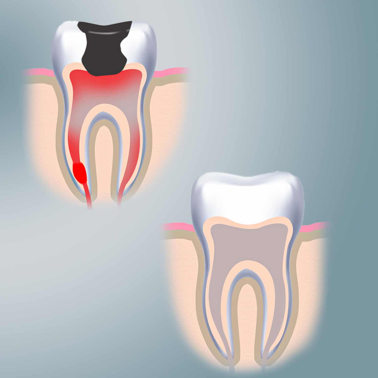procedure